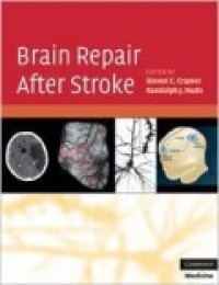 Brain repair after stroke