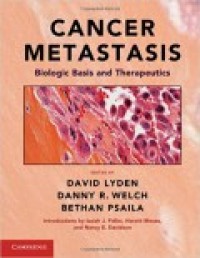 Cancer metastasis:biologic basis and therapeutics