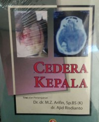 Cedera Kepala